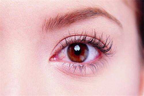 为什么眼睛总有红血丝？ 做好3个护理可快速消除！
