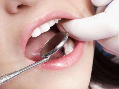 怎么改善洗牙后的酸痛感